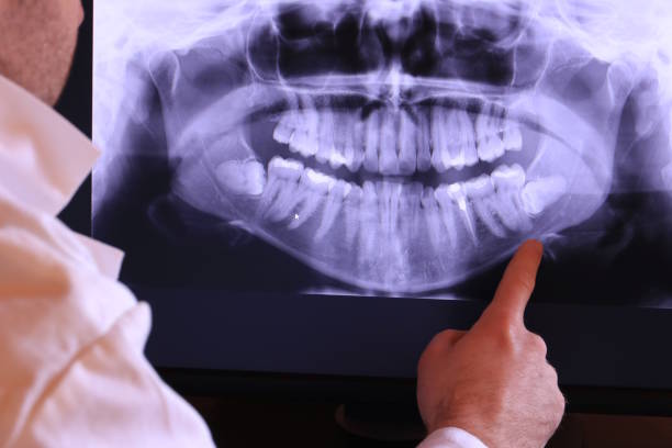 Best Emergency Treatment for Jaw Pain or Injury in Matthews, NC